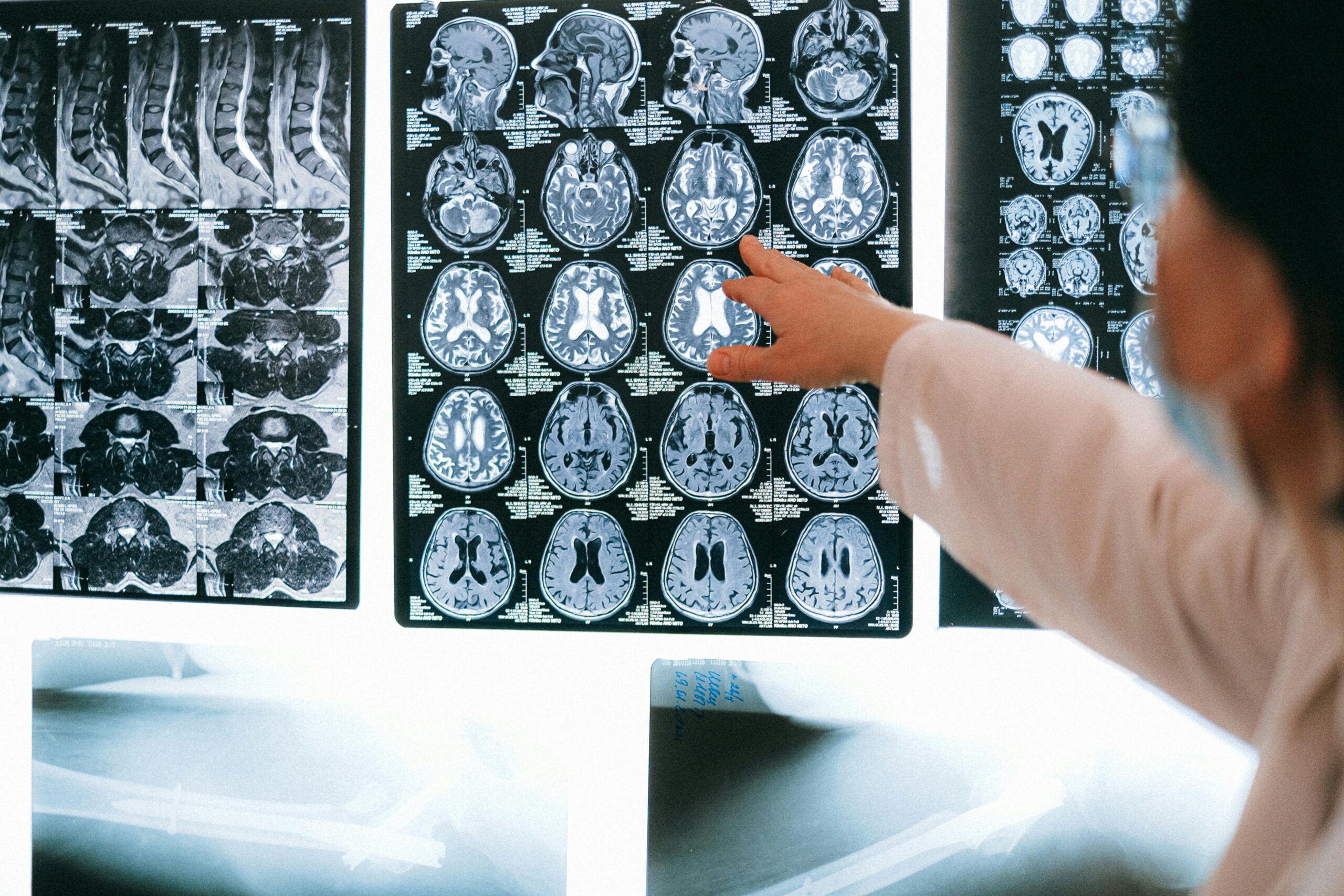 ISO 13485 Internal Auditor Training - Close up of MRI results